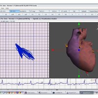 ECG visualizing application