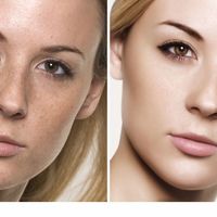Image touch-up/photo Retouching
