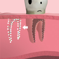 Illustration for dental brochure