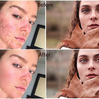 before/after