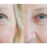 Remove wrinkles