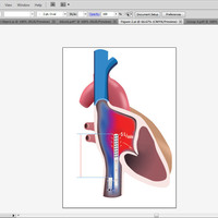 Medical illustrations