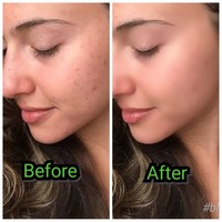 Retouch Photo