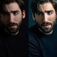 Before and after my beauty treatment for men