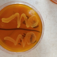 A study on Salmonellosis 