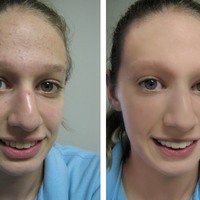 Photo Retouching