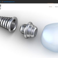 Implant helper website