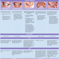 Web Research - Braces for Teens