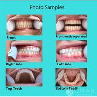 Images of dental braces