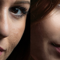 a detail of my beauty treatment, before and after