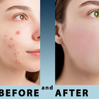 Beautification made in Photoshop