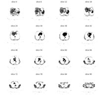 DICOM Image Segmentation via CNNs