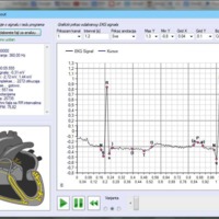 ECG analyzer, WinForms app