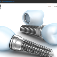 Implant helper website