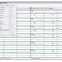 ECG recording application