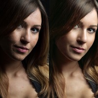 Before and after my beauty treatment