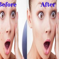 Face wrinkles removal