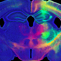  Computational Analysis of Drug Efficacy in Murine Models 