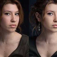 Before and after my beauty treatment